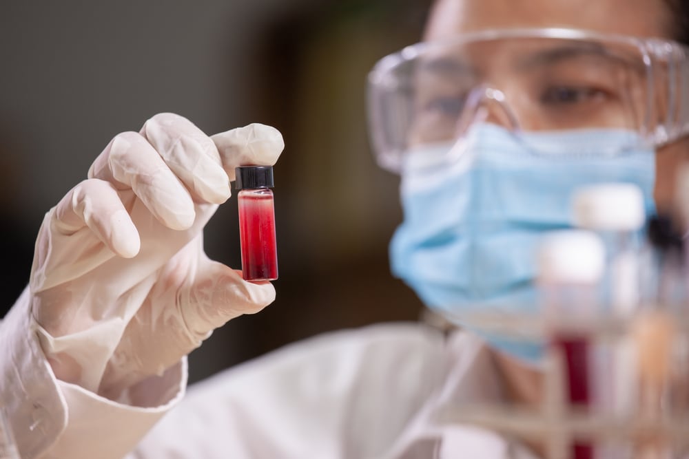 Genetic Testing